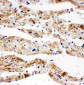 Anti-SDHB Antibody